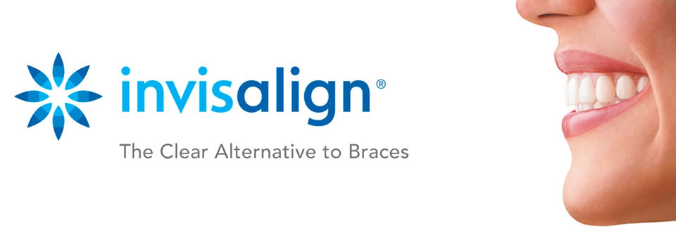 invisalign braces dublin